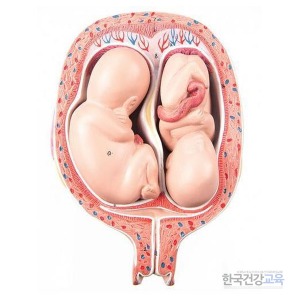 임신모형 5개월의 쌍둥이태아모형 L10/7 임신교육용품